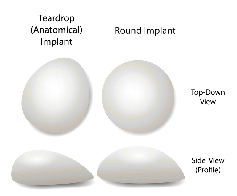 breast implant shapes for breast enlargement and lift
