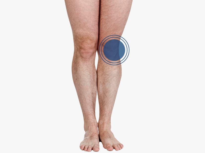 Orthopaedic Knee Surgery with Medbelle