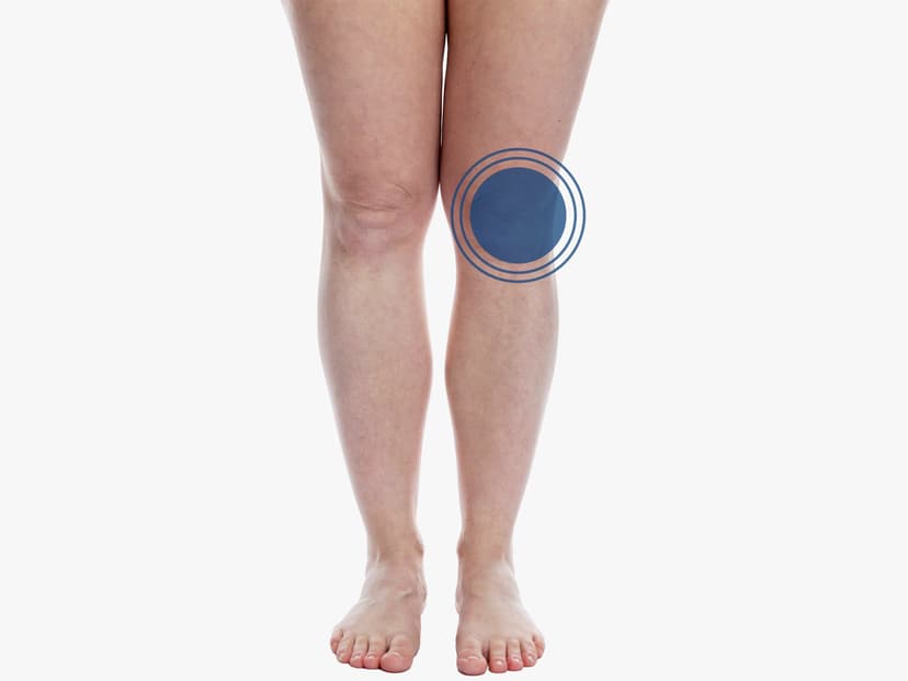 Orthopaedic Knee Surgery with Medbelle