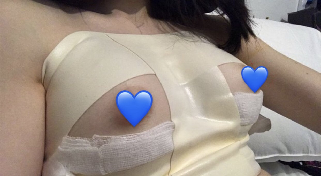 A few hours post-op image 1