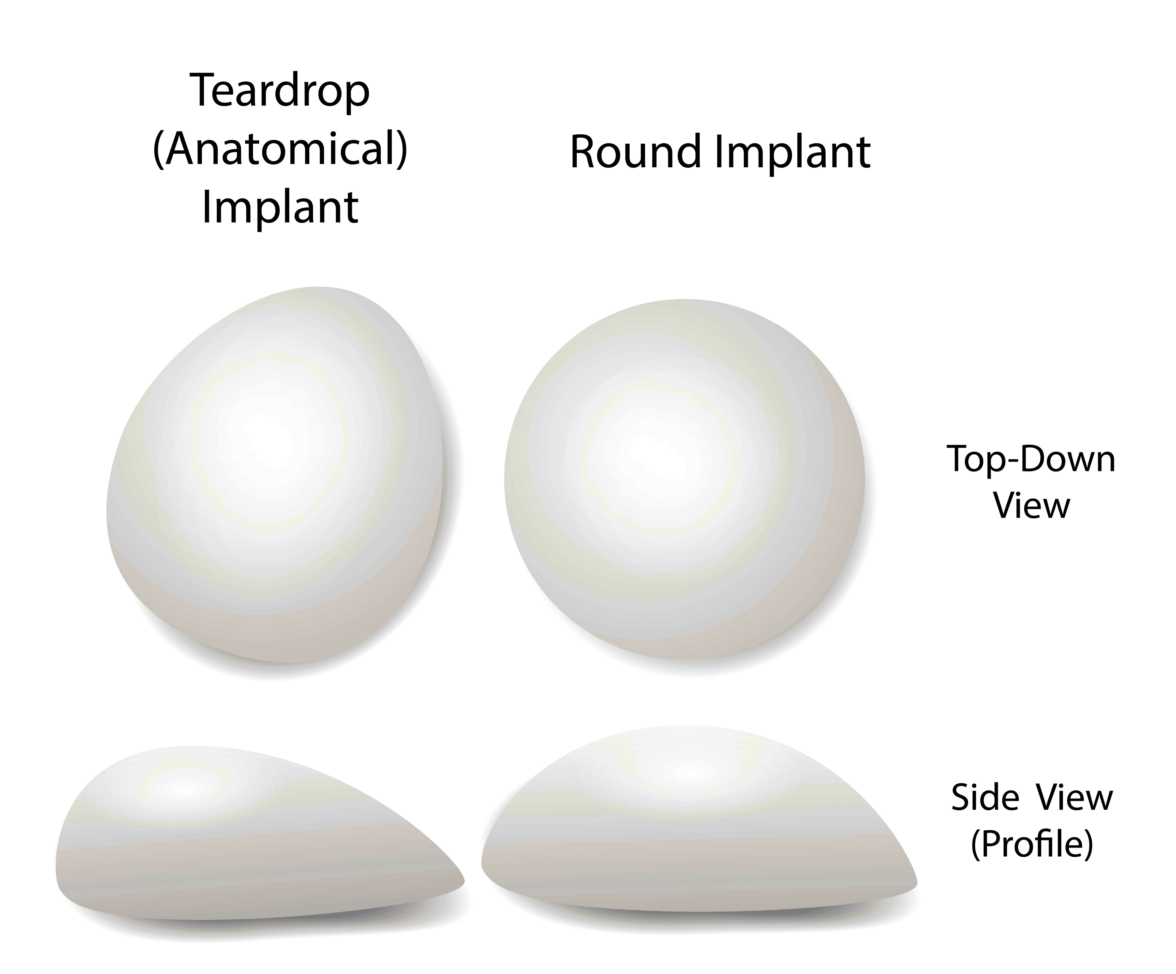 Breast implant shapes types breast enlargement