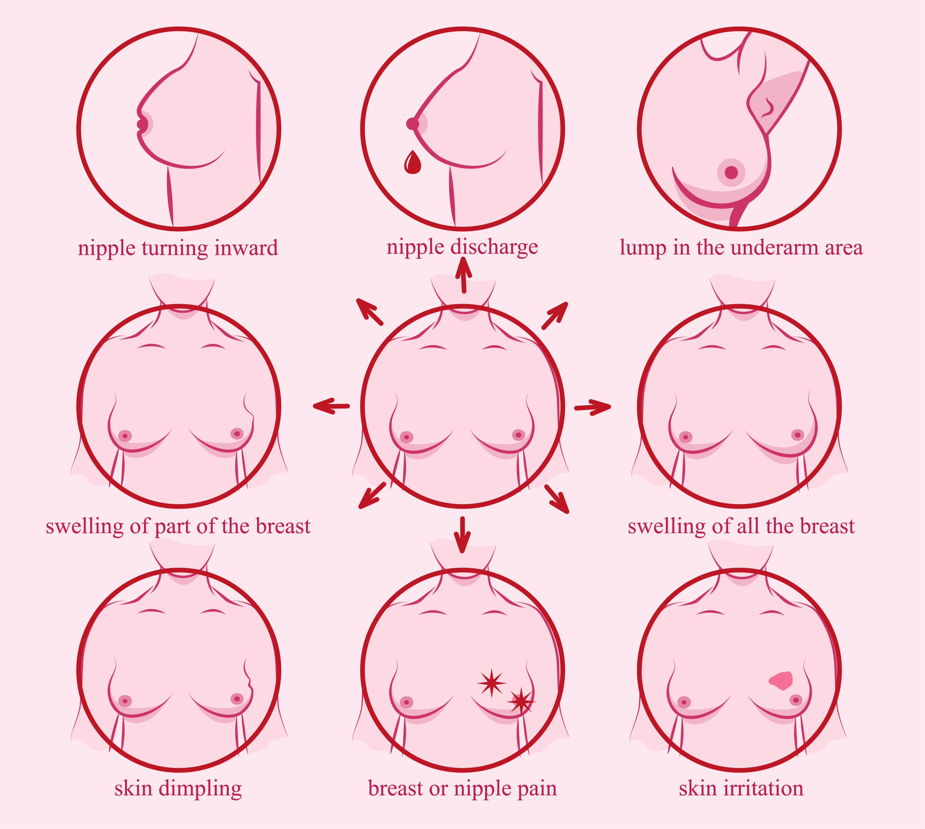 breast cancer symptoms