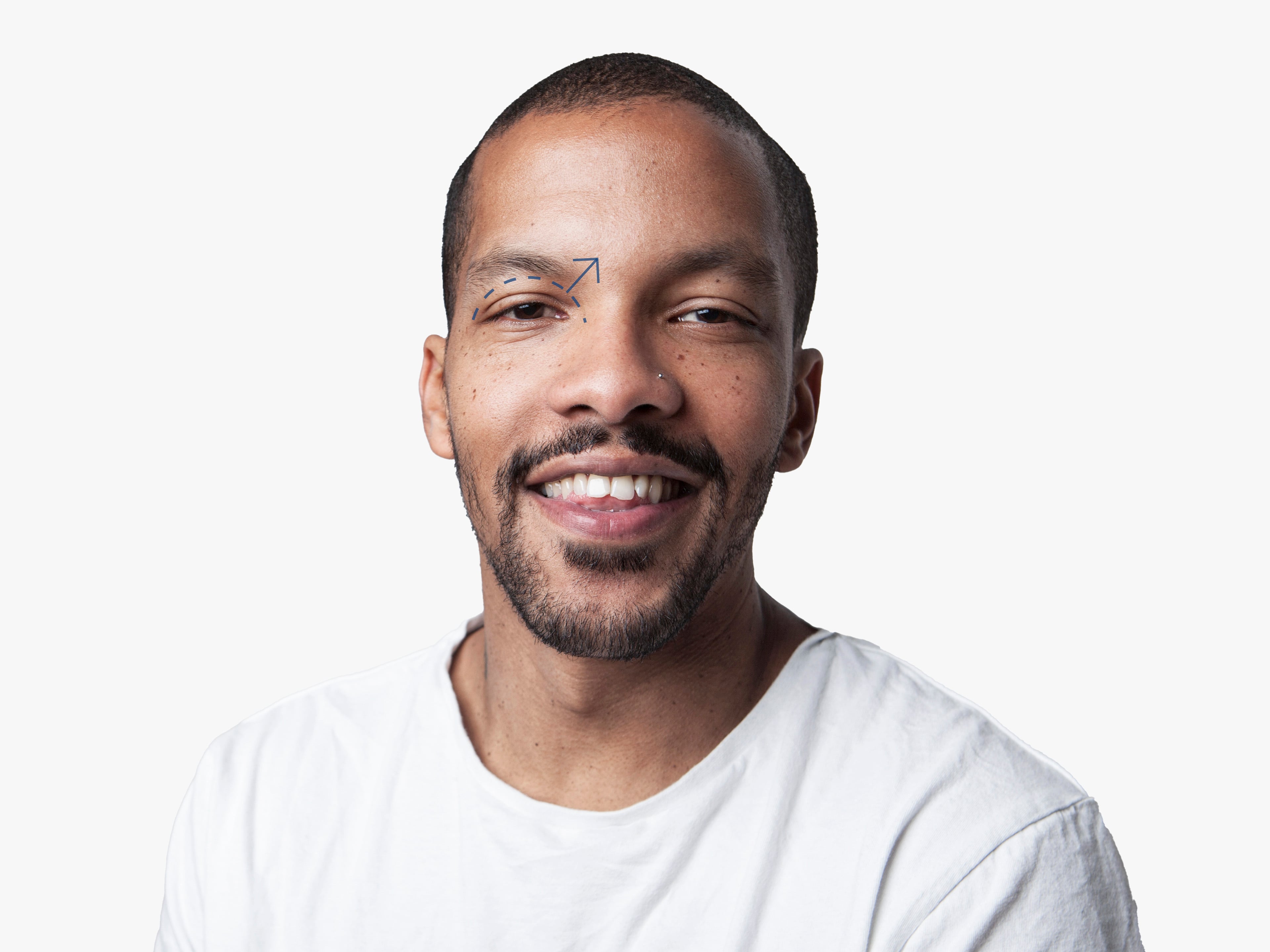 men eyelid surgery