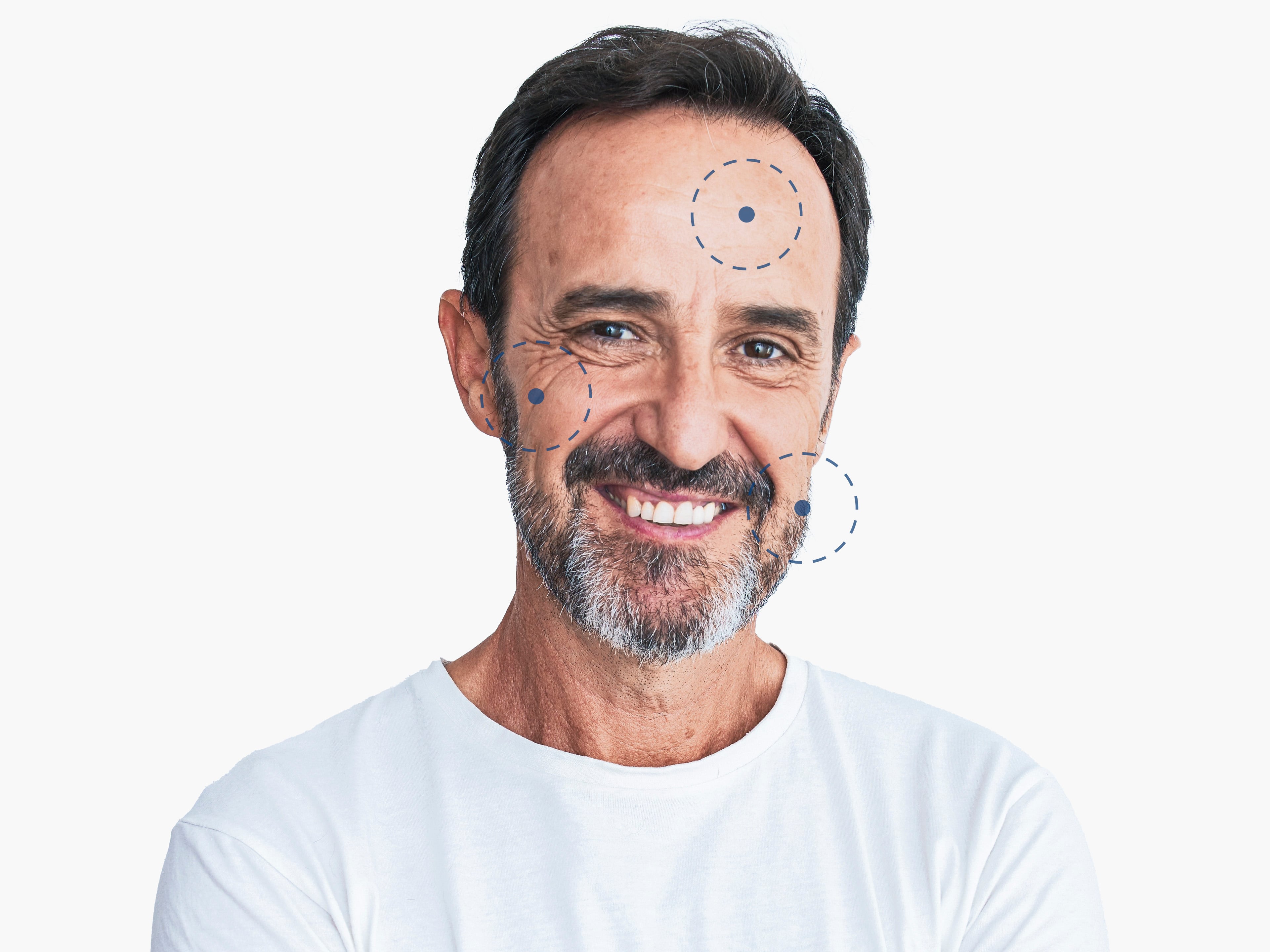 men facelift