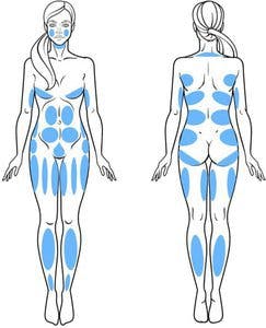 VASER Liposuction areas.jpg